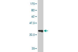 Western Blot detection against Immunogen (36. (GATA3 抗体  (AA 103-200))