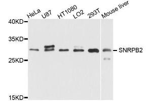 Western blot analysis of extracts of various cell lines, using SNRPB2 antibody (ABIN5995782) at 1/1000 dilution. (SNRPB2 抗体)