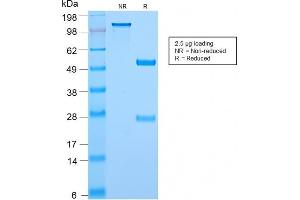 SDS-PAGE Analysis Purified c-Myc Rabbit Recombinant Monoclonal Antibody (MYC2895R).