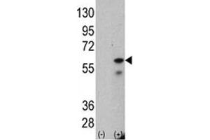 Western Blotting (WB) image for anti-PTEN Induced Putative Kinase 1 (PINK1) antibody (ABIN3028956)