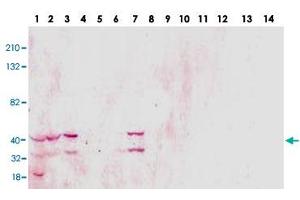 Western blot analysis of TSPY1 monoclonal antibody  in 14 different human cell lines. (TSPY1 抗体)