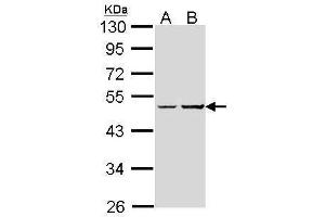 WB Image Sample (30 ug of whole cell lysate) A: Hep G2 , B: Raji 10% SDS PAGE antibody diluted at 1:1000