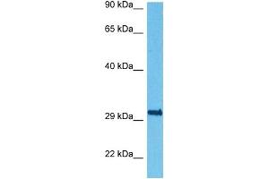 Host:  Rabbit  Target Name:  RCAN1  Sample Tissue:  Human HepG2 Whole Cell  Antibody Dilution:  1ug/ml