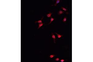 ABIN6266454 staining MCF-7  cells by IF/ICC. (Retinoblastoma 1 抗体  (pThr826))