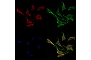 ABIN6258550 and ABIN6275237 staining 3 by IF/ICC. (MRPS30 抗体  (C-Term))