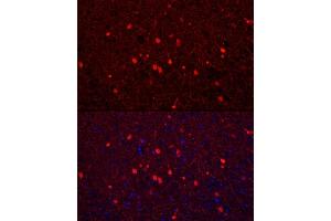 Immunofluorescence analysis of mouse brain using Calretinin Rabbit pAb (ABIN6129247, ABIN6137849, ABIN6137850 and ABIN6225108) at dilution of 1:250 (40x lens). (Calretinin 抗体  (AA 1-271))