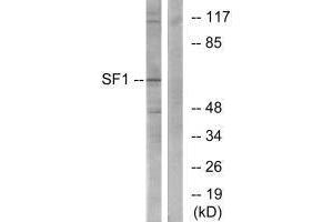 Western blot analysis of extracts from COLO205 cells, using SF1 (Ab-82) antibody. (Splicing Factor 1 抗体  (Ser82))