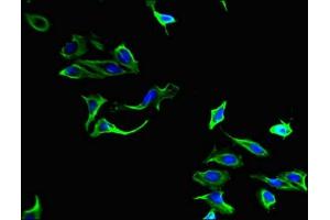 Immunofluorescent analysis of Hela cells using ABIN7149414 at dilution of 1:100 and Alexa Fluor 488-congugated AffiniPure Goat Anti-Rabbit IgG(H+L) (PLA2G4A 抗体  (AA 379-533))