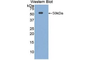 Western Blotting (WB) image for anti-Interleukin 10 Receptor, alpha (IL10RA) (AA 17-241) antibody (ABIN1859329) (IL-10RA 抗体  (AA 17-241))