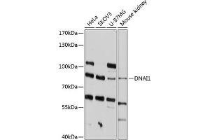 Western blot analysis of extracts of various cell lines, using DN antibody (ABIN6129798, ABIN6139690, ABIN6139691 and ABIN6215711) at 1:1000 dilution. (DNAI1 抗体  (AA 350-699))