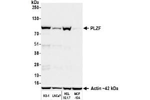 anti-Zinc Finger and BTB Domain Containing 16 (ZBTB16) (AA 6-126) antibody