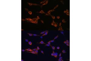 Immunofluorescence analysis of NIH-3T3 cells using YWHAH Polyclonal Antibody (ABIN6131142, ABIN6150348, ABIN6150349 and ABIN6224884) at dilution of 1:100 (40x lens). (14-3-3 eta 抗体  (AA 1-246))