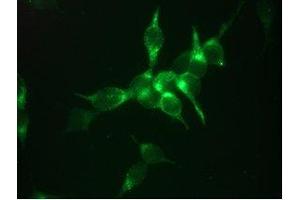 Immunofluorescent staining of LNCaP cells 1 (Prostate Specific Antigen 抗体)