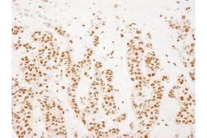 Immunohistochemistry (IHC) image for anti-RD RNA Binding Protein (RDBP) (AA 330-380) antibody (ABIN7448688) (RDBP 抗体  (AA 330-380))