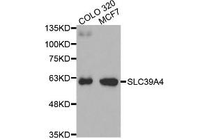 Western Blotting (WB) image for anti-Solute Carrier Family 39 (Zinc Transporter), Member 4 (SLC39A4) antibody (ABIN1874832) (SLC39A4 抗体)