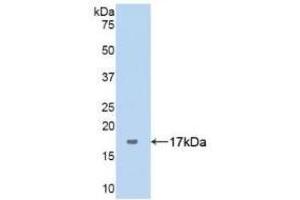 Detection of Recombinant ANXA5, Human using Polyclonal Antibody to Complement 1 Inhibitor (C1INH) (SERPING1 抗体  (AA 399-500))