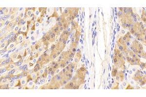 Detection of PGC in Mouse Stomach Tissue using Polyclonal Antibody to Pepsinogen C (PGC) (PGC 抗体  (AA 17-392))