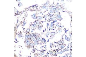 Immunohistochemistry (Paraffin-embedded Sections) (IHC (p)) image for anti-Somatostatin Receptor 5 (SSTR5) antibody (ABIN7270495)