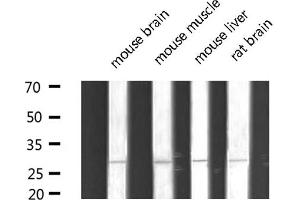 Western blot analysis of extracts of various tissue sample,using MYF5 Antibody . (MYF5 抗体  (N-Term))
