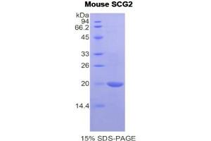 SDS-PAGE analysis of Mouse Secretogranin II Protein. (SCG2 蛋白)