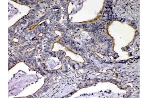 IHC analysis of NOV/CCN3 using anti-NOV/CCN3 antibody . (NOV 抗体  (C-Term))