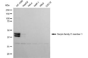 Western blotting analysis using serpin family E member 1 antibody (ABIN7799845). (Recombinant PAI1 抗体)