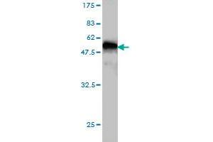 Western Blot detection against Immunogen (45. (PRKRIP1 抗体  (AA 1-184))