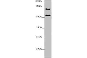 Western blot All lanes: CEP83 antibody at 2. (CCDC41 抗体  (AA 34-260))