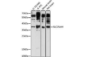 Western blot analysis of extracts of various cell lines, using SLC25 antibody (ABIN7270439) at 1:1000 dilution. (SLC25A44 抗体  (AA 90-190))