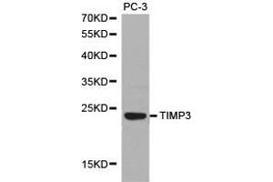 Western Blotting (WB) image for anti-TIMP Metallopeptidase Inhibitor 3 (TIMP3) antibody (ABIN1875099) (TIMP3 抗体)