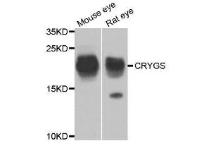 Western blot analysis of extracts of various cell lines, using CRYGS antibody. (CRYGS 抗体  (AA 1-178))
