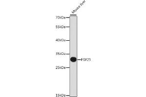 Western blot analysis of extracts of mouse liver, using FGF23 antibody (ABIN6133696, ABIN6140599, ABIN6140601 and ABIN6218305) at 1:1000 dilution. (FGF23 抗体  (AA 100-200))