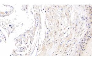 Immunohistochemistry (IHC) image for anti-C-Ros Oncogene 1 , Receptor tyrosine Kinase (ROS1) (AA 1945-2222) antibody (ABIN7427768)