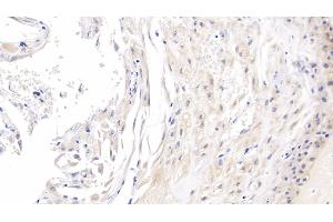Detection of ROS1 in Human Placenta Tissue using Monoclonal Antibody to C-Ros Oncogene 1, Receptor Tyrosine Kinase (ROS1) (ROS1 抗体  (AA 1945-2222))