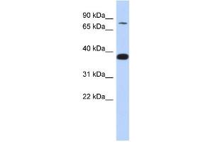 WB Suggested Anti-ZNF526 Antibody Titration:  0. (ZNF526 抗体  (N-Term))