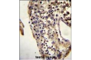 Immunohistochemistry (Paraffin-embedded Sections) (IHC (p)) image for anti-KH Domain Containing 3-Like, Subcortical Maternal Complex Member (KHDC3L) (AA 20-48), (N-Term) antibody (ABIN655185)
