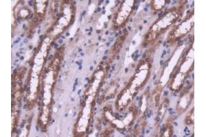 #VALUE! (HDAC4 抗体  (AA 904-1076))