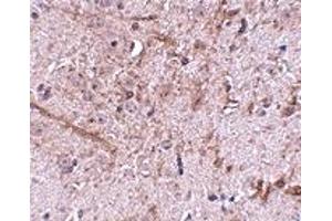 Immunohistochemistry (IHC) image for anti-Translocase of Outer Mitochondrial Membrane 70 (TOMM70A) (N-Term) antibody (ABIN1031635) (TOM70 抗体  (N-Term))