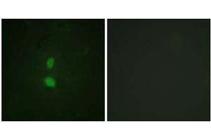 Immunofluorescence analysis of HuvEc cells, using SNAI1 (Phospho-Ser246) antibody. (SNAIL 抗体  (pSer246))