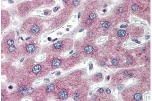 Human Liver (formalin-fixed, paraffin-embedded) stained with PTHR1 antibody ABIN334275 at 5 ug/ml followed by biotinylated anti-mouse IgG secondary antibody ABIN481714, alkaline phosphatase-streptavidin and chromogen. (PTH1R 抗体  (AA 146-169))