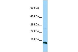 WB Suggested Anti-RPS28 Antibody Titration: 1. (RPS28 抗体  (N-Term))