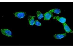 IF analysis of AGFG1 using anti-AGFG1 antibody (ABIN3043530).