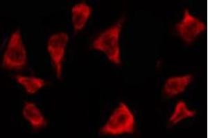 ABIN6278606 staining MCF7 by IF/ICC. (OR2T3/2T34 抗体)