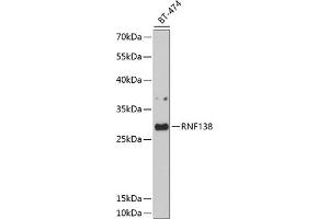Western blot analysis of extracts of BT-474 cells, using RNF138 antibody (ABIN6128751, ABIN6147014, ABIN6147015 and ABIN6214506) at 1:1000 dilution. (RNF138 抗体)