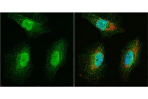 Immunofluorescence (IF) image for anti-Williams Beuren Syndrome Chromosome Region 22 (WBSCR22) (Center) antibody (ABIN2856201)