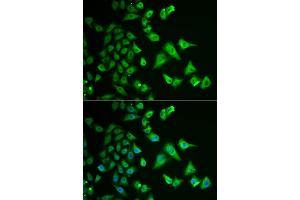 Immunofluorescence analysis of HeLa cells using DHRS2 antibody (ABIN5973846). (DHRS2 抗体)