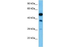 Host:  Mouse  Target Name:  FEN1  Sample Tissue:  Mouse Testis  Antibody Dilution:  1ug/ml (FEN1 抗体  (N-Term))