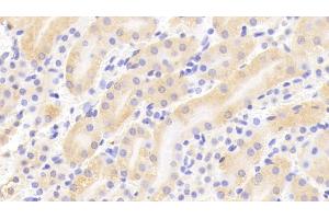 Detection of TPSb2 in Mouse Kidney Tissue using Polyclonal Antibody to Tryptase Beta 2 (TPSb2) (TPSB2 抗体  (AA 30-276))