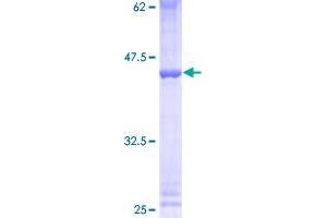 ZNF93 Protein (AA 1-123) (GST tag)