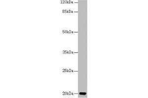 Western blot All lanes: CETN3 antibody at 1. (CETN3 抗体  (AA 1-167))